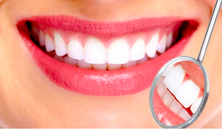 Diş Teli Rengi Nasıl Seçilir?